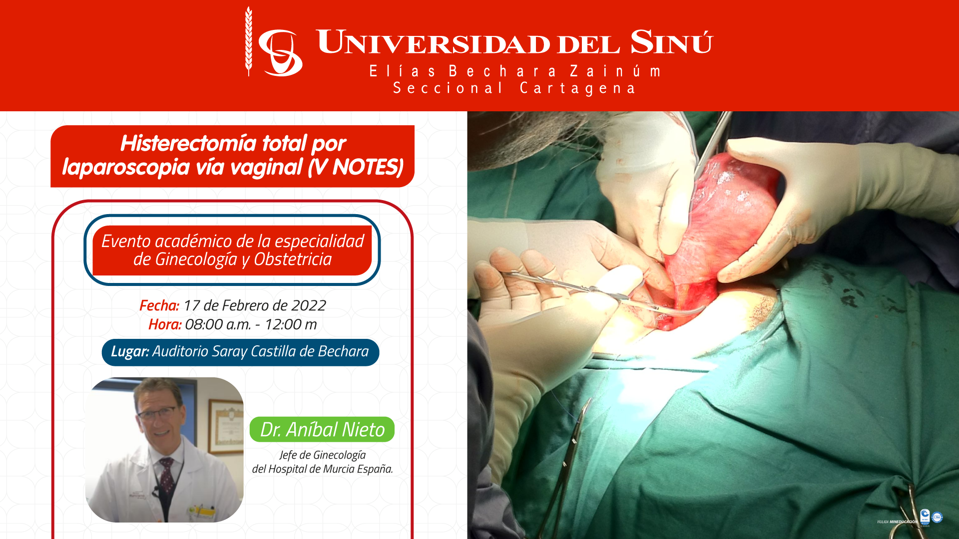 Histerectomía Total Por Laparoscopia Vía Vaginal V Notes Universidad Del Sinú Seccional 5889